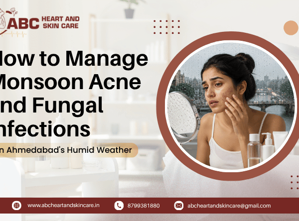 How to Manage Monsoon Acne and Fungal Infections in Ahmedabad's Humid Weather