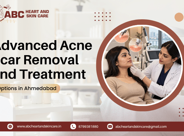 Advanced Acne Scar Removal and Treatment Options in Ahmedabad