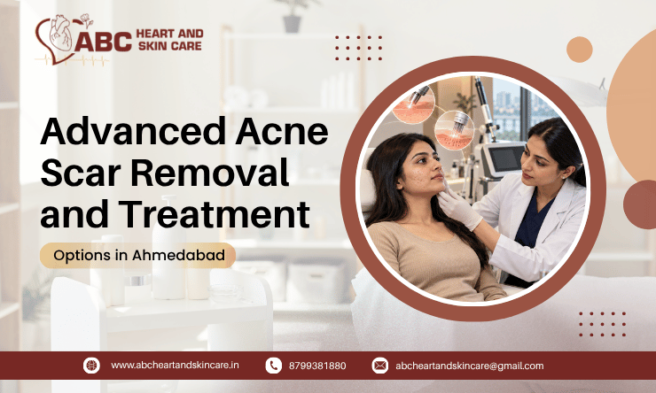 Advanced Acne Scar Removal and Treatment Options in Ahmedabad